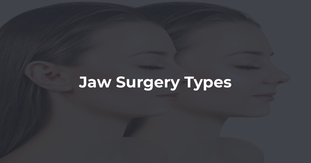 Jaw Surgery Types at Southern Dental Implants & Oral Surgery